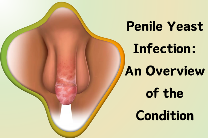 Penile Yeast Infection: An Overview of the Condition